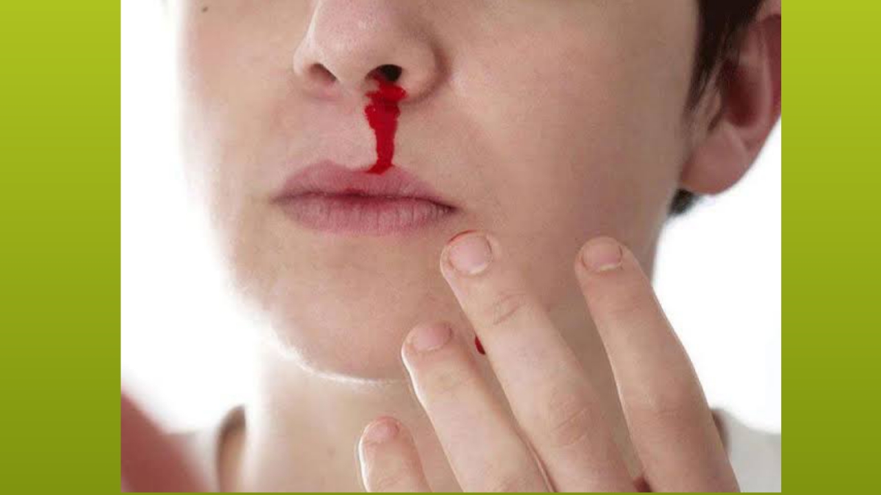 Nose bleeding treatment in marathi
