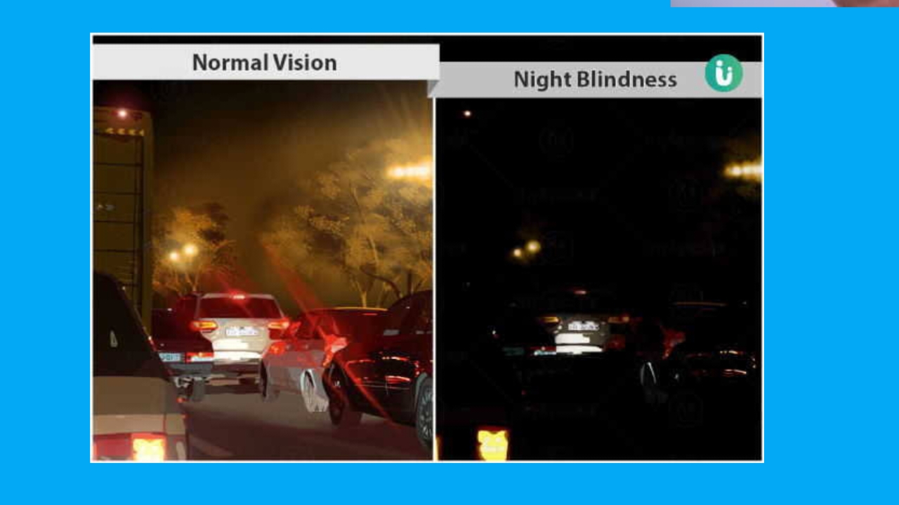 Night blindness in marathi